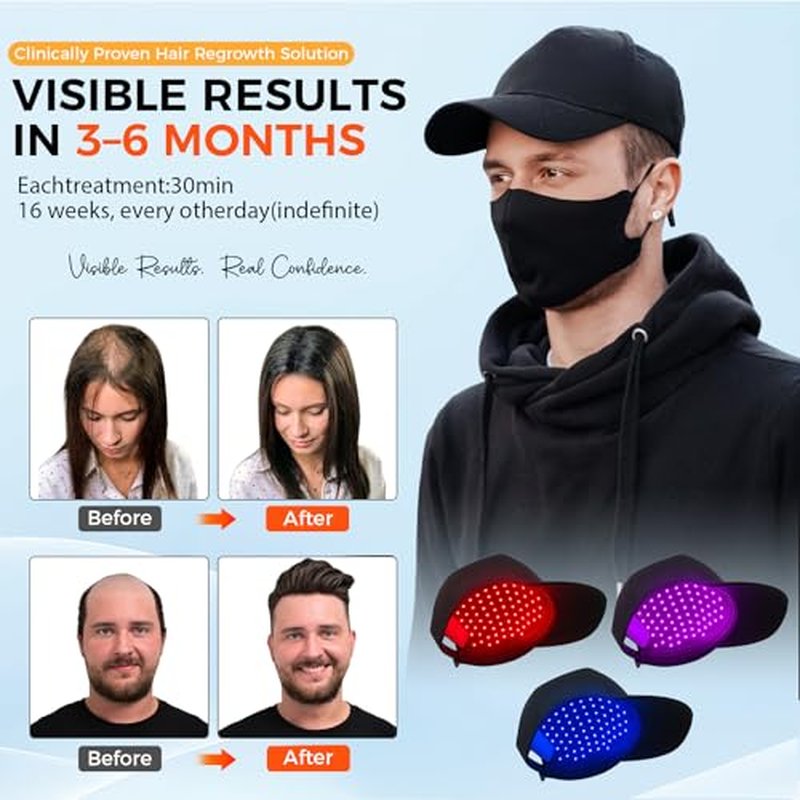 Red Light Hair Growth Cap - Laser Hair Growth Cap, The Adjustable Portable Laser Cap, Promote Hairs