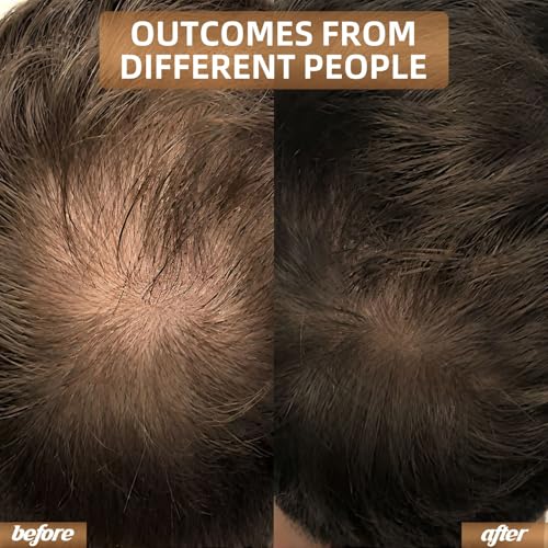 Red Light Therapy for Hair Growth, Laser Cap Hair Regrowth For Women and Men