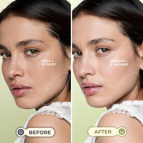 Dermaplane Razor for Women Face, WLU Rechargeable Face Dermaplaning Tool ? Peach Fuzz, Facial Hair & Exfoliation Removal, Sonic Technology with LED Light, 3 Speeds & 10 Blades (Green)