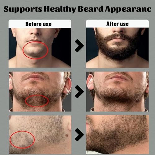 Para Barba, Crecimiento De Barba Para Hombre, Beard Stimulating Balm Beard Cream, Estimulante De Barba Ultra Potente, Beard Balm for Men Growth Oil, Balsamo Negro Moisturizes Strengthens (1PCS)