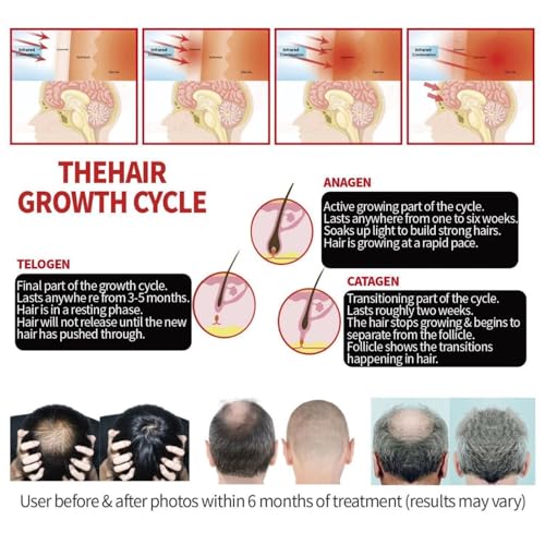 SweetOnes Premium Hair Regrowth Loss Care Treatments Supplyment Products AD-2