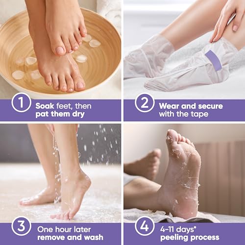 Foot Peel Mask - Foot Mask for Baby Soft Skin - Remove Dead Skin, Dry, Cracked Feet & Callus, Foot Spa, Made with Aloe Vera Extract for Women and Men (2 Pair (Pack of 1), Lavender)