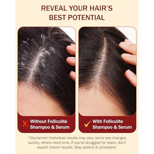 Folliculitis Treatment Shampoo & Serum with 3% BHA, Salicylic Acid, Tea Tree Oil & Chamomile Extracts - Anti Itch Shampoo for women & men with Flaky Scalp Treatment Acne, Made in USA by e70, 8 fl oz