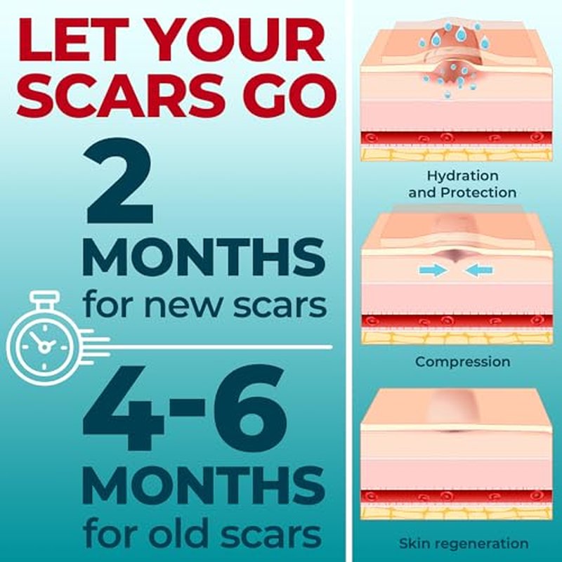 Medical Grade Silicone Scar Sheets - 6pk (5.7¡±x1.6¡±) - Visible Difference on Surgical & Keloid Marks - Reusable C-Section Scar Silicone Strips - Easy to Use Strips