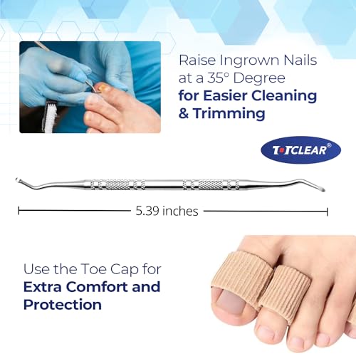Ingrown Toenail Relief: Ingrown Toenail Tool for Men Women - Ingrown Toenail Removal Kit - Ingrown Toenail Corrector Drops - Ingrown Toenail Removal - Effective Solution for Ingrown Toenails - 30ml