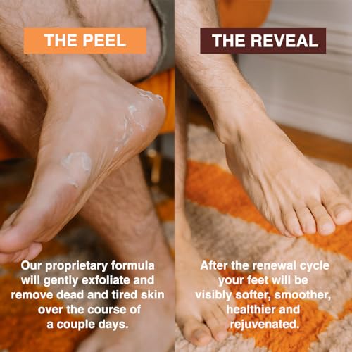 FEETS Foot Peel Mask with Eucalyptus and Lavender (2-Pack) | Remove and Exfoliate Dead Skin | Perfect for Men and Women | Removes and Repairs for Dry, Rough, Cracked Heels and Calluses