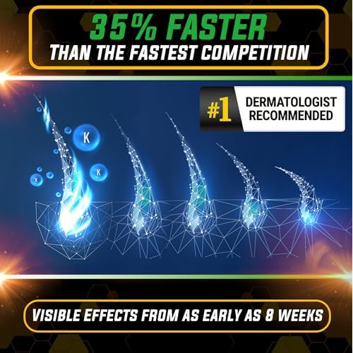 Elevate Hair Regrowth Treatment 5% Minoxidil Spray - Extra Strength Formula Professional Treatment for Hair Loss and Thinning for Regrowth - Stimulate Follicles for Men and Women 1 Month Supply