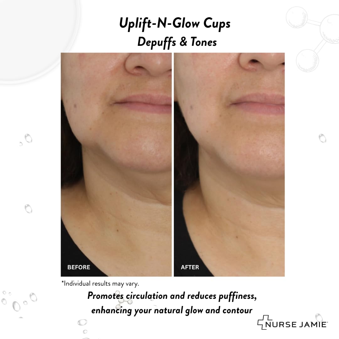 Nurse Jamie Uplift-N-Glow Facial Cupping Tool – Silicone & Glass Cups for Facial Drainage, Product Absorption & Skin Revitalization