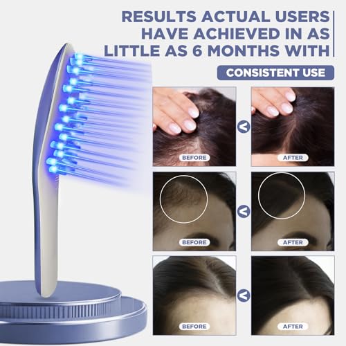 Laser Therapy Hair Growth Comb Model:Lasercomb-001, Hand-held Comb-Shaped Low Level Laser Therapy Device That emits Laser Light Designed to Promote Hair Growth in Women and Men.