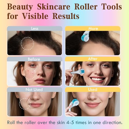 Derma Roller - TUMAKOU Microneedle Roller for Face Scalp Hair - Beard Roller for Women and Men