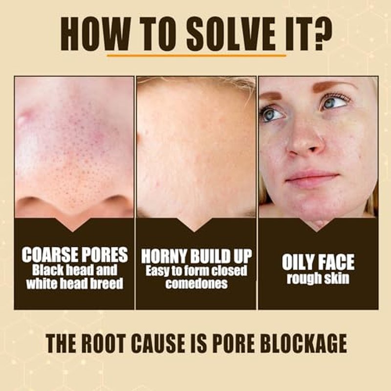 Lactobionic Acid Pore Refining Serum,Minimize Pores Serum Gentle Formula Clean Pore Shrink Pore Firming Skin Reduce Fine Lines Facial Liquid for All Skin
