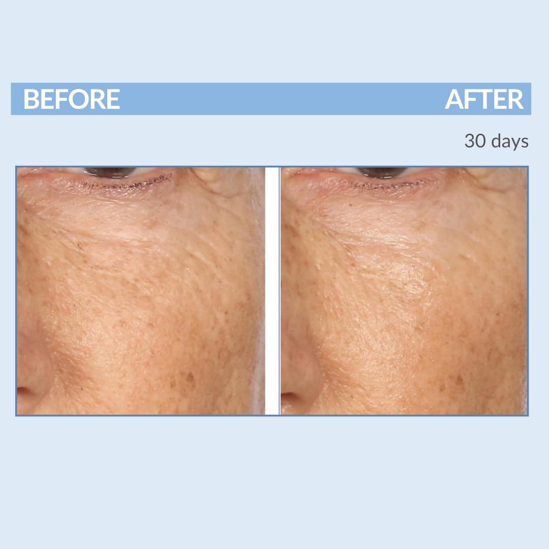Serious Skincare Retinol A Eye XR Under Eye Cream - Reduce Fine Lines & Dark Circles | 0.5 oz Anti-Aging Treatment