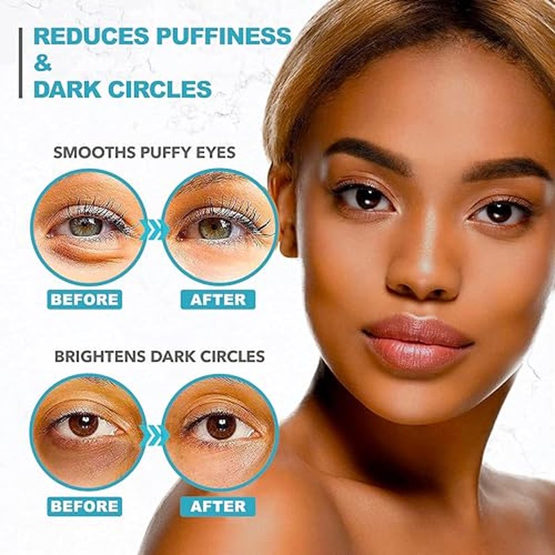 Under Eye Patches For Puffy Eyes And Dark Circles - Retinol Collagen Under Eye Masks - Reduce Wrinkles & Bags - Skin Treatment Pads - Anti Aging Moisturizer Mask For Women Gift - 60 Gel Pads