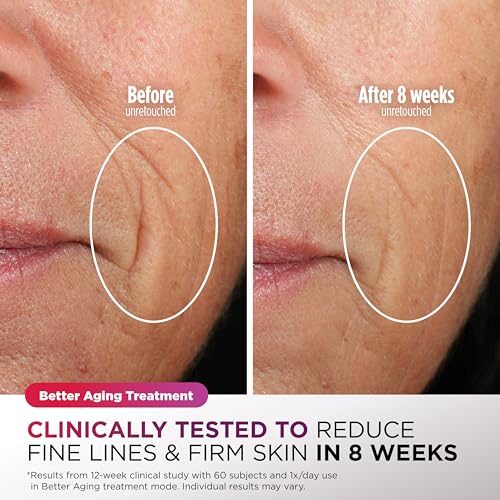 Shark CryoGlow LED Face Mask with Under-Eye Cooling, Anti-Ageing & Blemish Repair, Red & Blue LED, Infrared Light Therapy, USB-C, Remote Control, Storage Bag, Blue Frost, FW312