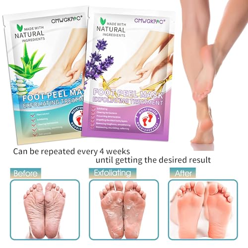 5 Pack Foot Peeling Mask,Exfoliator Peel Off Calluses Dead Skin Callus Remover,Foot Mask for Dry Cracked Feet,Foot Peel Masks for Men and Women Feet Peeling Mask for Stocking Stuffers