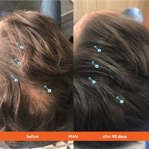 DS Labs Revita Shampoo & Conditioner Kit, 925mL ? Scalp First System for Fuller Looking, Volumized Hair, Lightweight Hydration, Sulfate & Silicone Free, Color Safe, For Men & Women