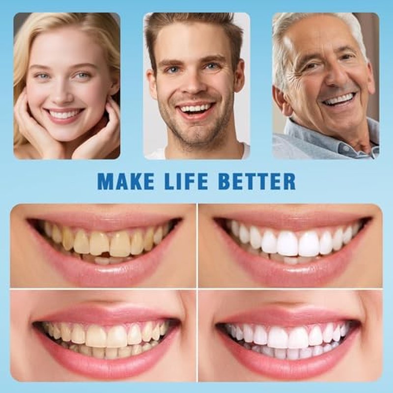 Moldable False Teeth - Silicone Dentures - Men and Veneers Teeth for Women - Upper and Lower Matching Set - Fix Your Smile at Within Minutes - 1PCS - Z