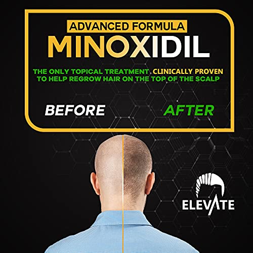 ELEVATE 5% Minoxidil Hair Growth Spray - Alcohol Free Non Oily Formula Extra Strength Professional Treatment for Hair Loss/Regrowth - Stimulate Hair Follicles for Men & Women - 1 Month Supply