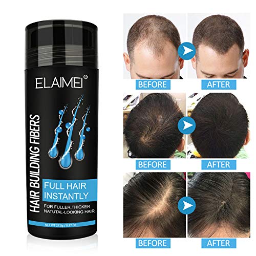 Hairline powder Hair fiber natural hair fiber Apply to men women Get thick hair Conceals Hair Loss (Medium Brown)