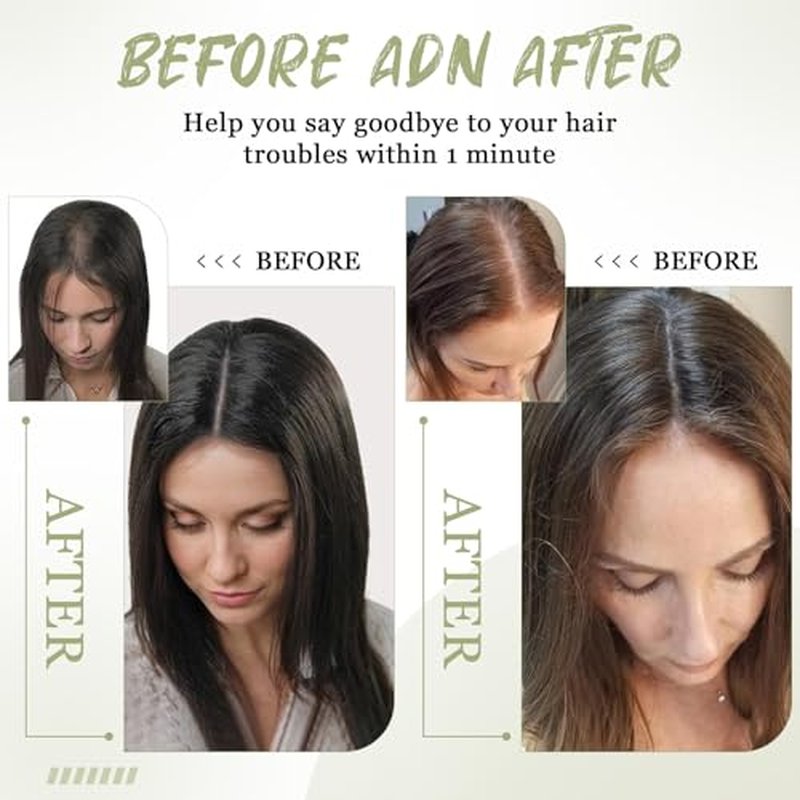 Urbeauty Hair Toppers for Women Real Human Hair for Thinning, 16 inch 1.5¡±x5¡±Silk Base Upgrade Topper, Clip-in Volume Enhancer, Natural-Looking, No Glue, Breathable, Lightweight