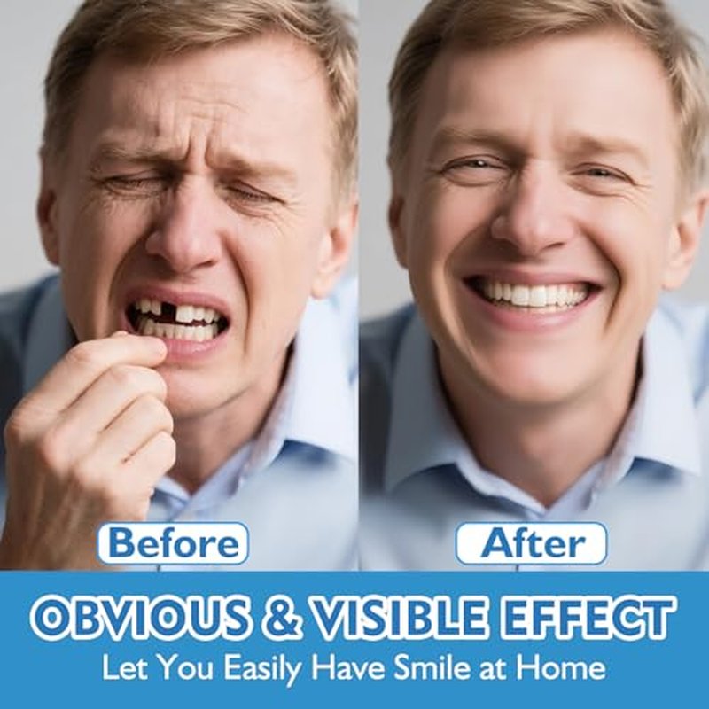 Moldable False Teeth - Veneers Teeth for Women & Men, Silicone Dentures Set for Both Upper and Lower, Temporary Dentures DIY at Home Within Minutes Fix Your Smile 1Pack