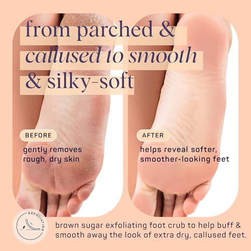 SpaLife Beauty Brown Sugar Foot Scrub ? Exfoliating Foot Treatment for Dryness & Roughness ? Sugar Scrub for Feet ? Made with Shea Butter & Sweet Almond Oil to Soften & Smooth Skin