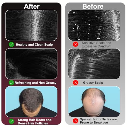 Laser Therapy Hair Growth Comb, 3 in 1 Hair Oil Applicator for Hair Care, 360¡Æ Electric Scalp Massager, Stimulates Hair Regrowth for Men & Women, IPX7 Waterproof