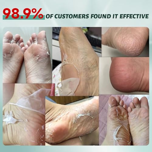 VGO 3 Pack Foot Peeling Mask, Natural Exfoliating Foot Mask, Dead Skin Callus Remover Repair Heels, Smooth Touch Feet, Hydrating Foot Care for Dry Cracked Feet