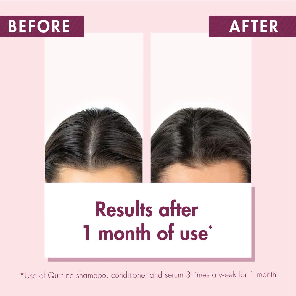 Klorane Shampoo with Quinine and B Vitamins for Thinning Hair, Support Thicker, Stronger, Healthier Hair, Men & Women, 6.7 Fl Oz