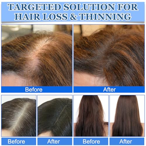 Advanced Hair Growth Roll-On Serum,Hair Growth Serum Roll On,Promotes Growth, Reduces Hair Loss, Nourishes Scalp & Roots,For All Hair Types(3Pcs)