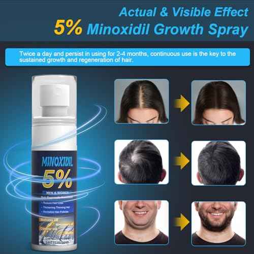 5% Minoxidil for Men and Women, Hair Growth Biotin Serum with Batana and Rosemary for Hair beard Regrowth Treatments, Extra Strength Hair Loss Solution to Regrow Thicker, 2.02FL OZ