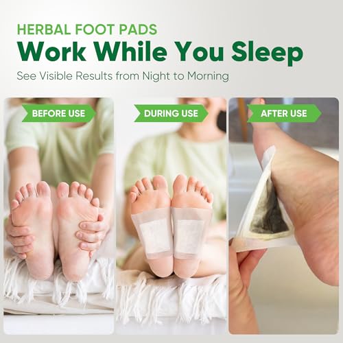 Natural Cleansing Foot Pads - Premium Foot Care - Relieves Stress and Fatigue - Improves Sleep and Supports Body Cleansing - 30 Pads