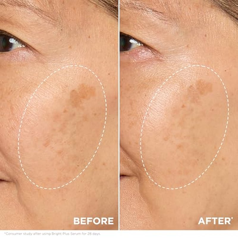 Clarins Bright Plus Serum | Visibly Brightens and Boosts Radiance | Evens Skin Tone | Targets Dark Spots | Contains Vitamin C and Niacinamide | All Skin Types | 1 Fluid Ounce