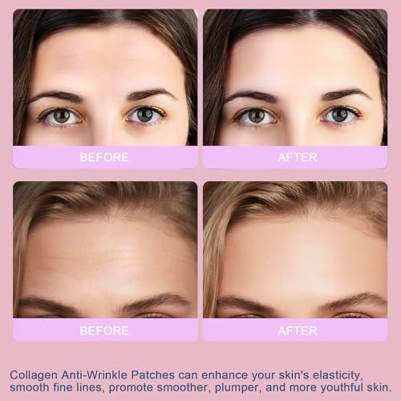 Forehead Wrinkle Patches, Collagen Anti Wrinkle Patches Overnight, Forehead Serum Patch Smooth Fine Lines & Wrinkles, Soft Facial Patches 16 Pcs
