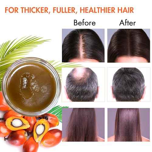Raw Batana Oil for Hair Growth, 100% Natural Pure Dr. Sebi Botana Oil from Honduras, Unrefined Organic for Prevent Hair Loss, Enhances Thickness for Men & Women 5.3 oz