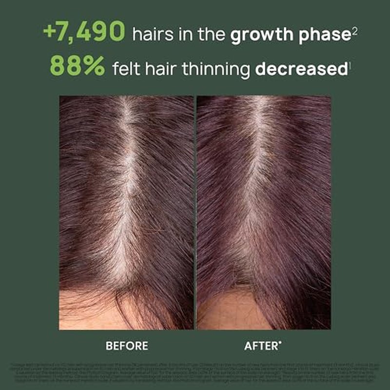 Rene Furterer Triphasic Progressive Concentrated Serum for Hereditary, Hormonal Thinning Hair - Drug-Free - Receding Hairline - Leave-In - Sulfate, Paraben, Silicone-Free - 8 ct., 30-Day Supply