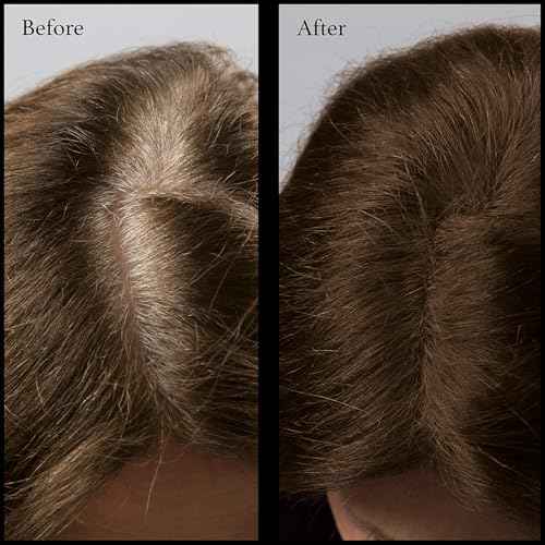 Hair Root Touch Up Powder - Dark Brown - 11 True-to-Nature Root Concealer Shades - Long-lasting, Fragrance Free, Talc & Paraben Free - Without Brush