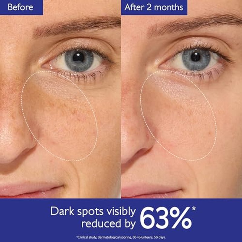 Caudalie Vinoperfect Brightening Dark Spot Serum Vitamin C Alternative - 62x More Effective than Vitamin C with Viniferine for a Visibly Brighter Even Complexion
