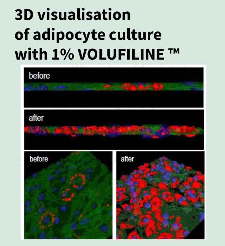 100% Volufiline 10ml (0.37 Fl Oz) Patented Cosmetic Ingredient from SEDERMA (France) Just Add A Few Drops DIY Skin Care Cosmetic Ingredient