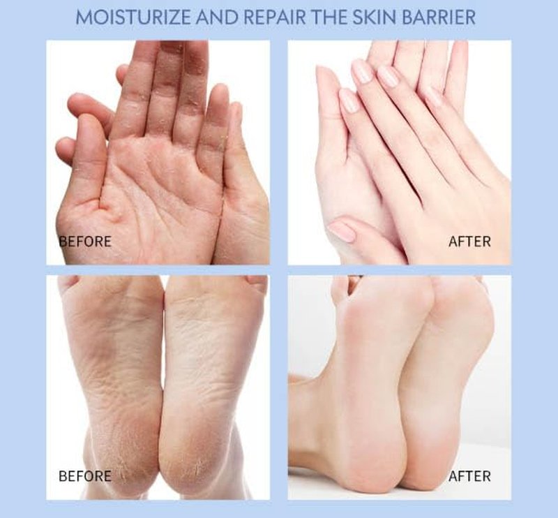 Lexenic Anti-Crack Foot Cream - Moisturizing Foot Care for Dry, Cracked Heels | 2-Pack, Nourishing & Softening Formula