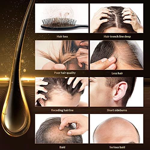 Magic Hair Growth Tonic with Ginseng ? 60ML Hair Loss Treatment for Men & Women, Fast Hair Regrowth Serum for Thicker, Fuller Hair