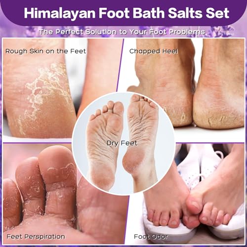Tea Tree Oil Foot Soak Stubborn Foot Odor, Athletes Lavender Foot Soak with Pure Epsom Salt Soak Pedicure Salt Athletes Foot & Stubborn Foot Bath Salt Softens Calluses & Soothes Foot Care spa¡¦