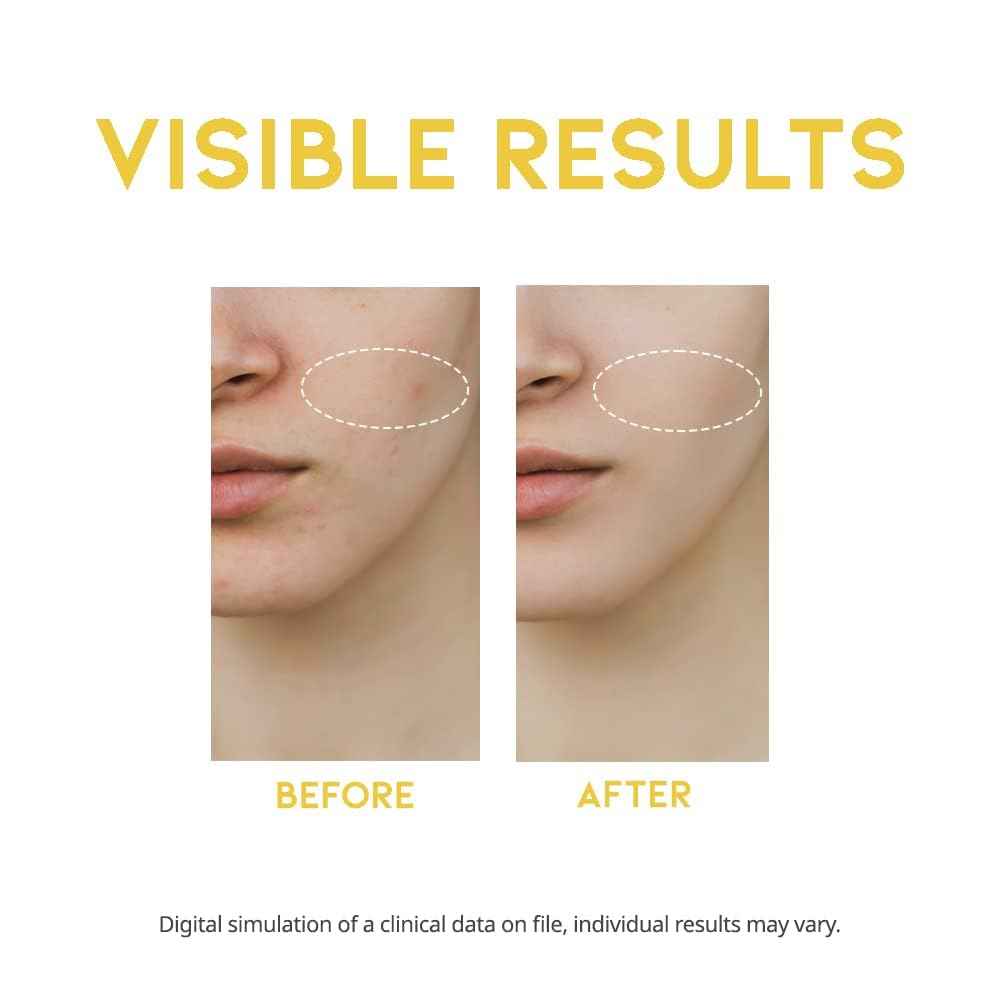 Vitamin C Serum for Face Korean, Brightening, Ascorbic acid, Vitamin Tree Water 1.69 Fl Oz