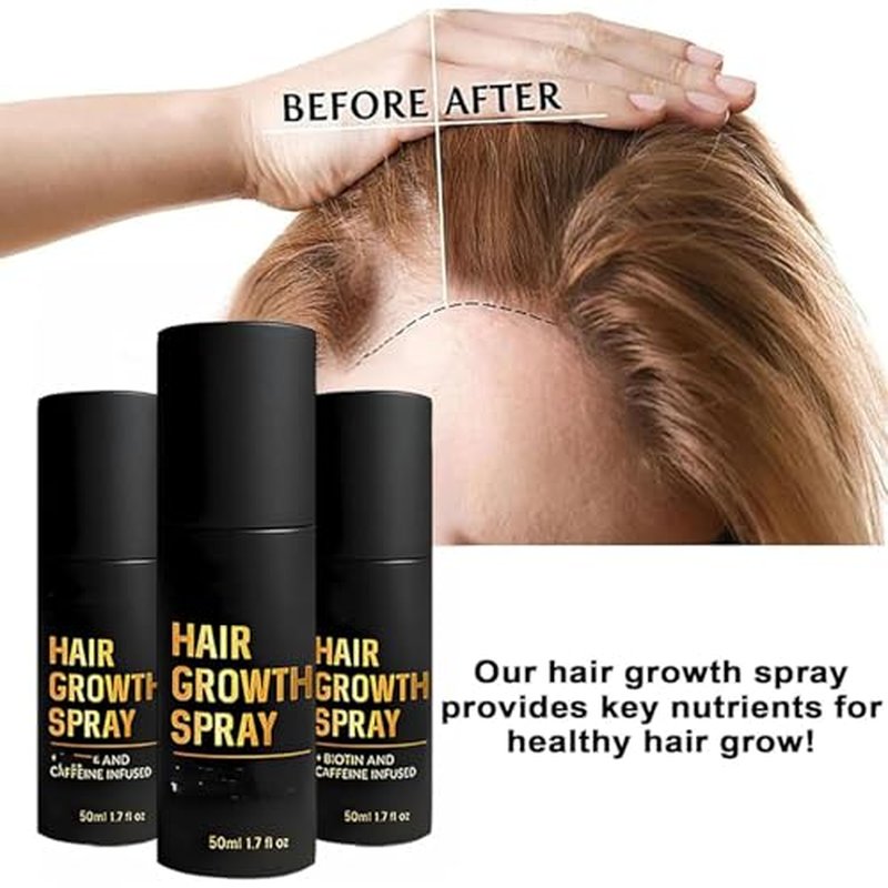 HairGrow Hair Growth Spray, Promotes Thicker, Fuller Hair For Women & Men ? All Hair Types, Hair Thickening Sprays With Natural Ingredients