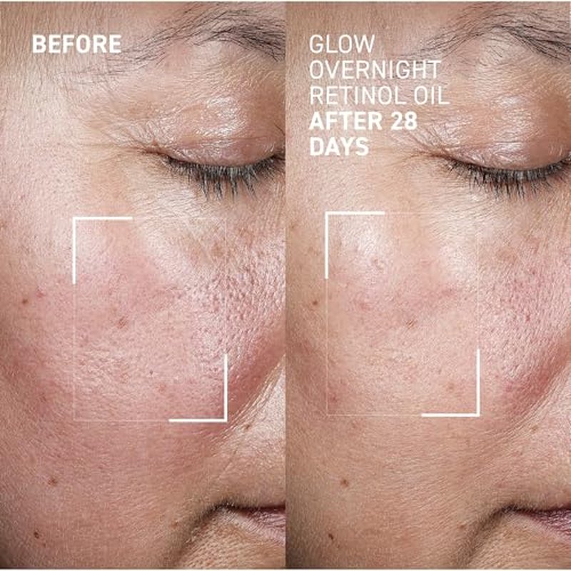 Dr. Brandt Bright This Way Glow Overnight Retinol Oil - Pure 2% Retinol Improves Wrinkles, Lines & Skin Texture - 1 fl oz