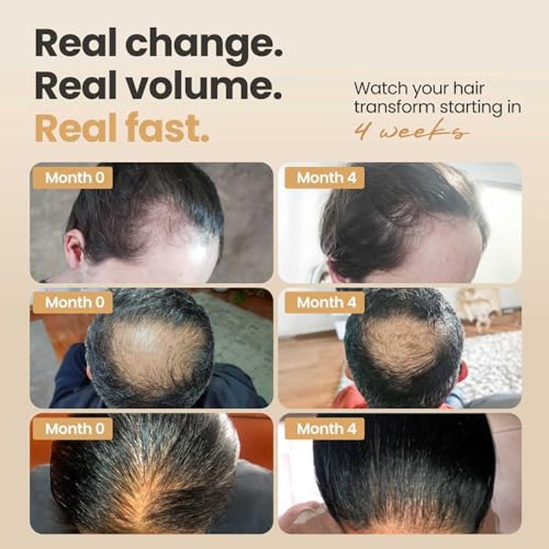 Vitasei Hair Booster 2 Fl Oz (3 Pack) ? Hair Revitalizing Serum with Capilia Longa, Wild Olive Stem Cells & Arginine ? Peptide-Enriched Hair Tonic Supports Thicker, Stronger Hair ? For Women & Men