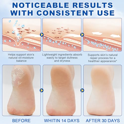 60% Urea with 2% Salicylic Acid Urea Foot Care Stick, Heel Stick for Cracked Feet, Foot Care Cream Moisturizer for Dry Cracked Feet, Knees, Elbows, Hands, Foot Lotion Stick -1.41oz