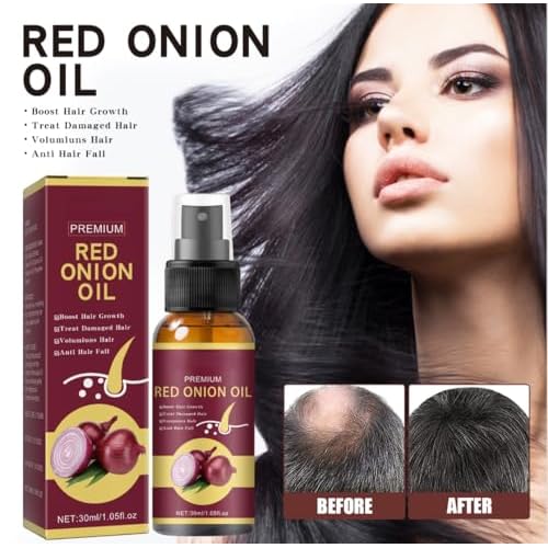 Premium Red Onion Oil for Hair Growth, Anti Hair Fall Treatment, 30ml/1.05fl.oz