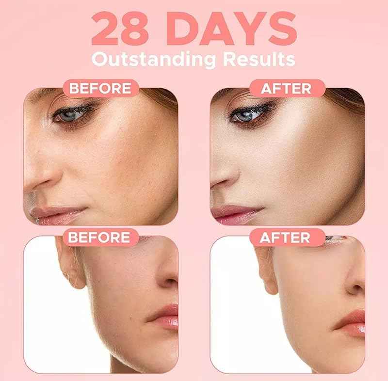 MZ Ideas Vitamin C Moisturizer face Cream - Neck and Decollete, Brighten skin - Reduces Wrinkles and fine lines, deep hydration and firming - Made in USA, 1.7 fl oz