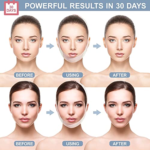 Galeboy Double Chin Reducer, Face Slimming Strap, V Line Lifting Mask Chin Strap For Women And Men, Anti-Wrinkle Face Mask For Double Chin And Shaggy Face Skin